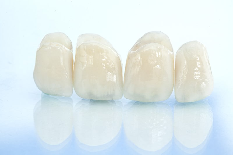 ceramic dental crowns